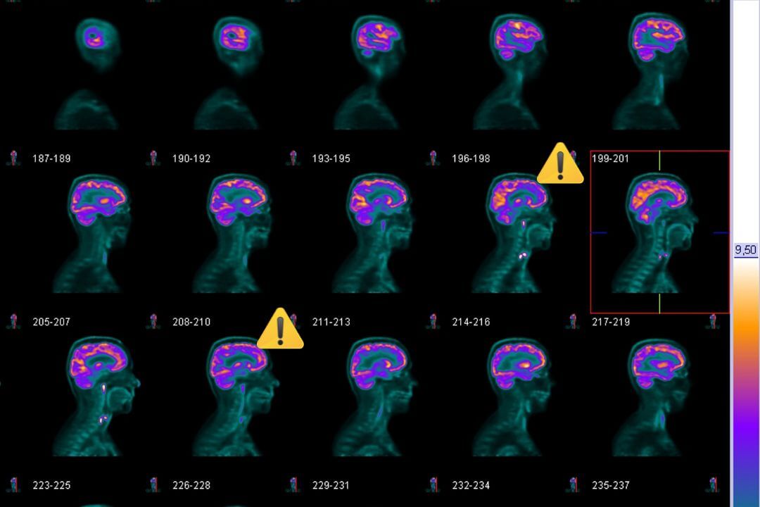 Ghidurile BrainMap — ghiduri practice pe afecțiuni